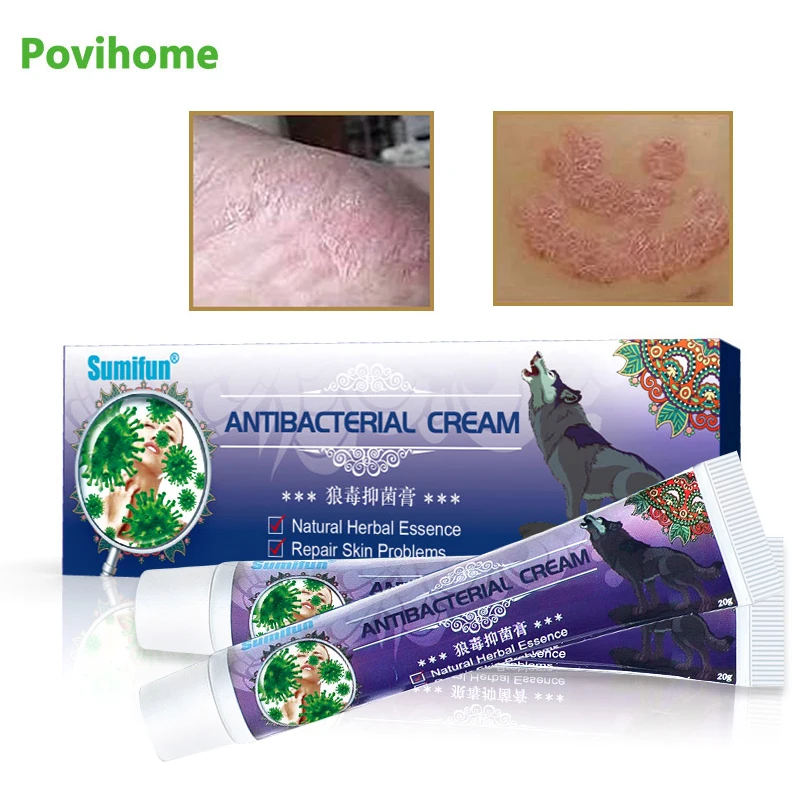 

1pcs 20g Skin Inflammation Treatment Ointment Antibacterial Cream For Psoriasis Dermatitis Eczema Wolf Venom Medical Plaster