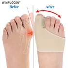 Носки для педикюра, большие, для костей ортопедический, 1 пара, силиконовый корректор вальгусной деформации большого пальца стопы, разделитель пальцев ног, уход за ногами