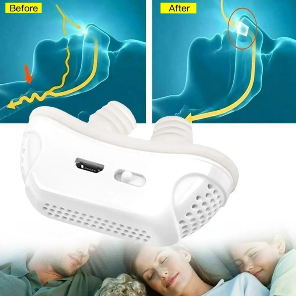 

Electric Anti-snoring Device Household Anti-snoring Device Nasal Dilator Anti Snoring Device Professional Sleep Aid Unisex