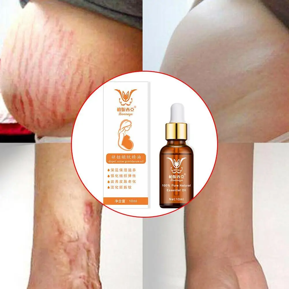 

Stretch mark remover essential oil eliminate scars repair anti maternity treatment pregnancy skin firming winkle V4F3