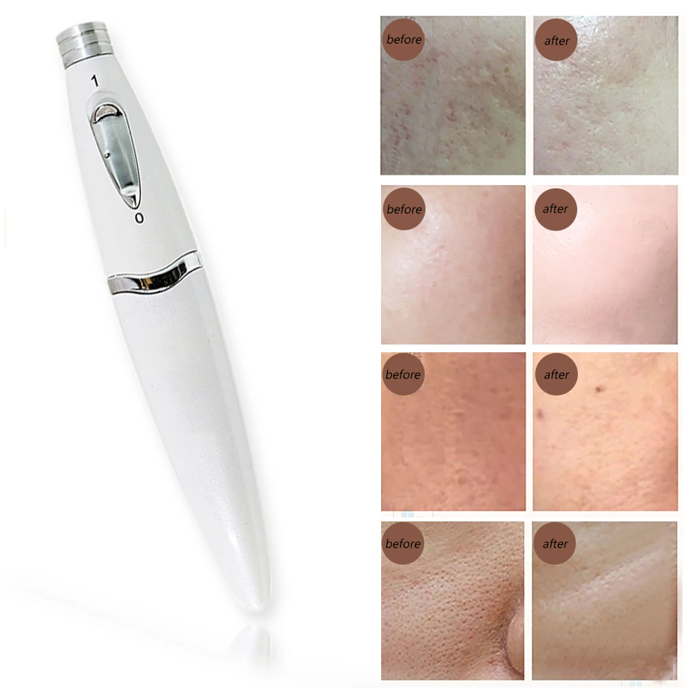 Nano Microneedling пера кожи Mezoroller инструмент нано маска для удаления угрей массажер