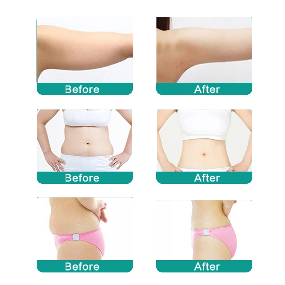 

Liposonic Slimming Body machine Anti-Cellulite Massager Therapy Treatment Weight loss Belly Fat Removal salon home equipment