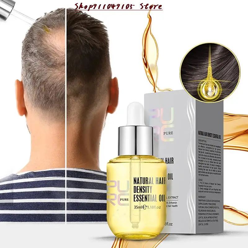 

Ginger Essence Hair Growth Products Fast Regrowth Oil Serum Hair Loss Medicine