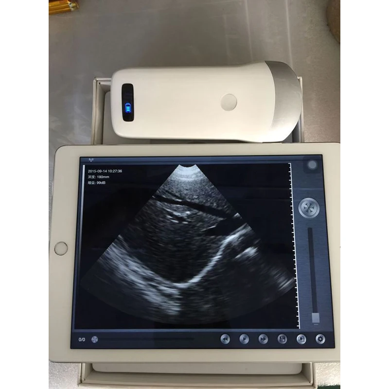

good quality usb ultrasound probe for laptop