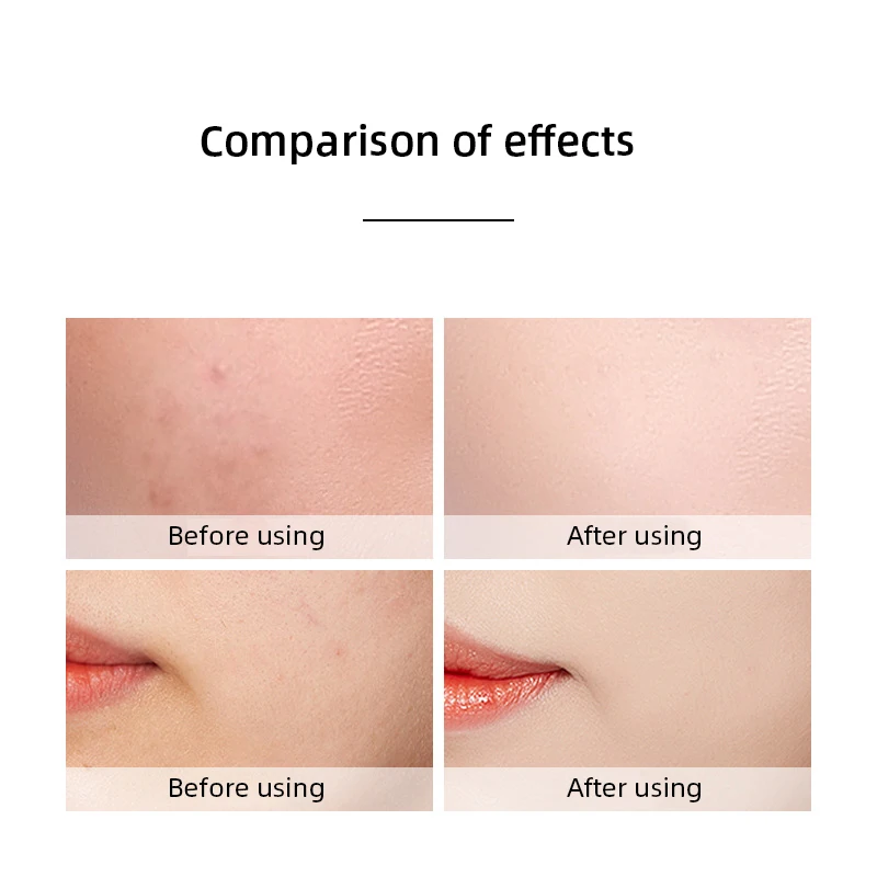 Сыворотка против морщин для лица Nicotinamide эссенция жидкая увлажняющая Освежающая