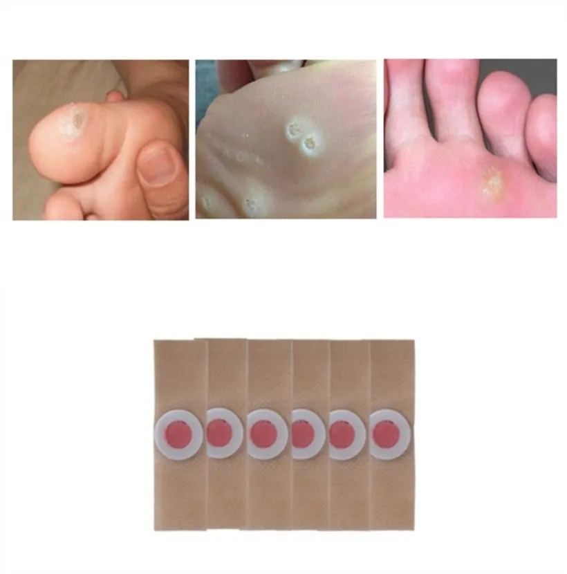 18 шт медицинские пластыри кукурузы удаления бородавки шип патч лечебный патчи