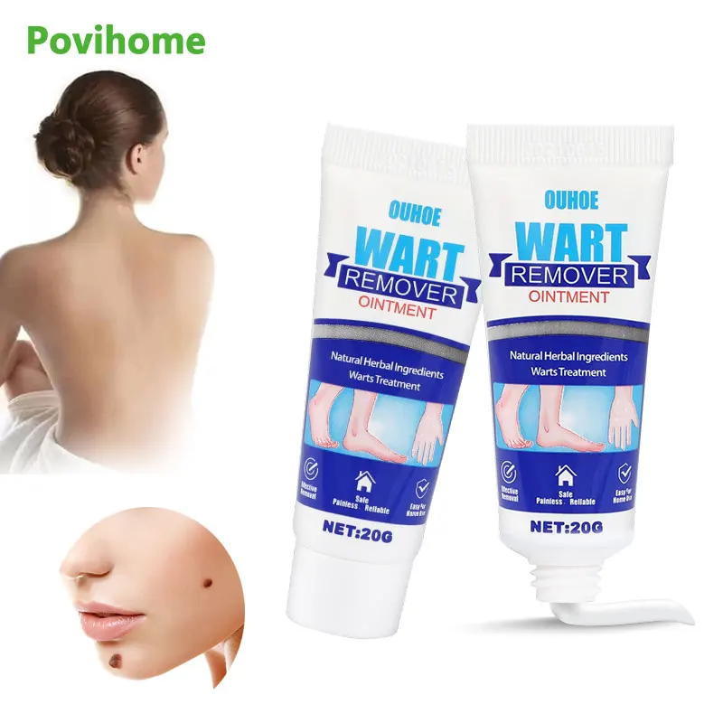 

1/2pcs Warts Removal Cream For Skin Tags Treatment Mole Remove Ointment Painless Remove Wart Foot Corn Ointment Skin Care Beauty