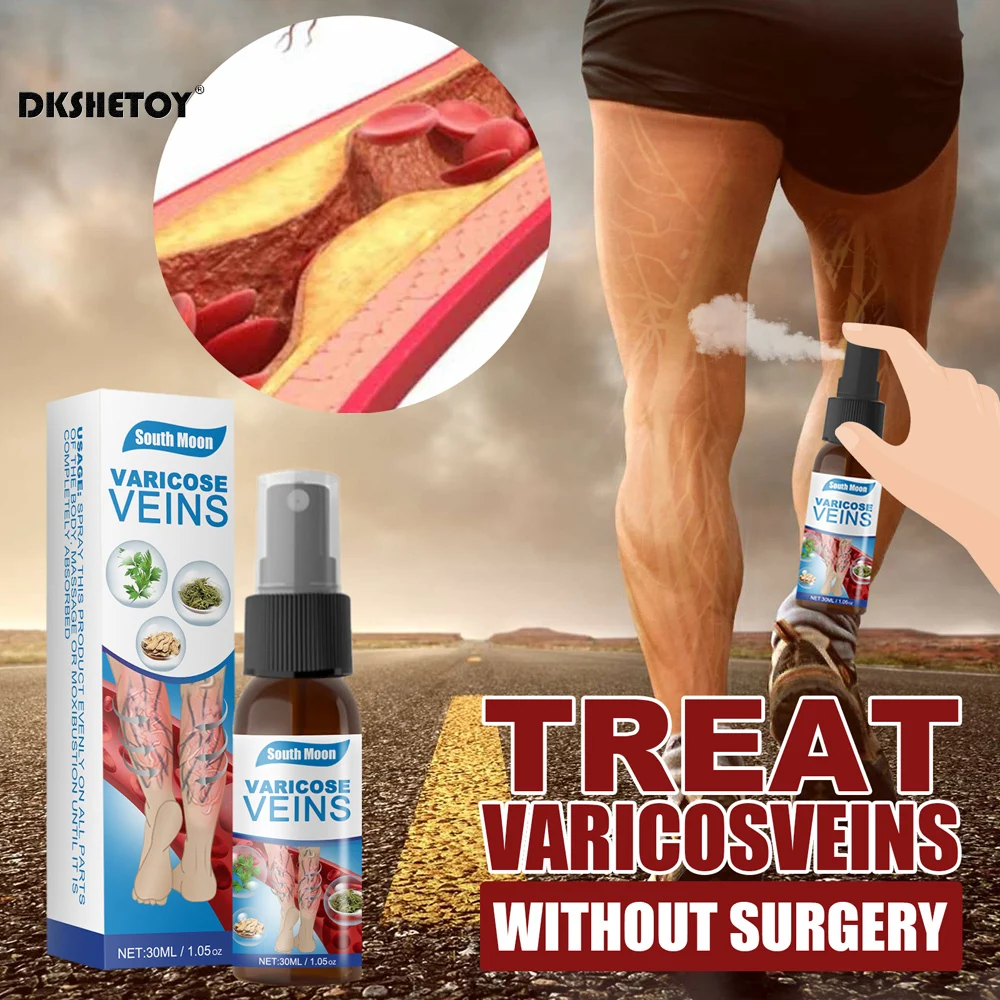 

Лечение Варикозного расширения вен, эфирное масло для облегчения флебита, ангиита, лечение боли, спрей для паутины, отечности вены, нервной боли в ногах