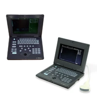 palm size ultrasound fetus machine laptop ultrasound scanner diagnostic machine with ce