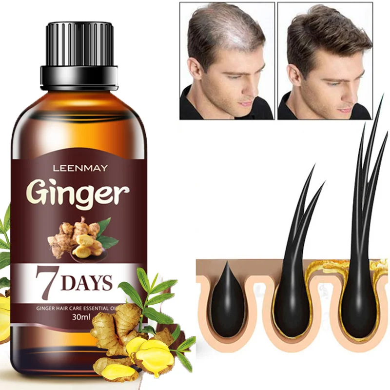 

7 Days Hair Growth Serum Essential Oils Ginger Treatment Hair Loss Essence Fast Nourishing Soften Scalp Repair Damaged Hair Care