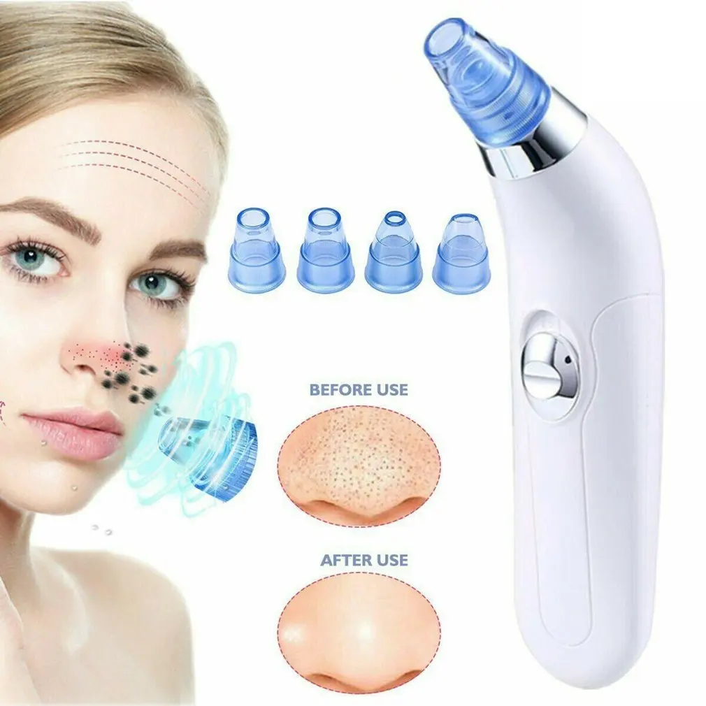 

Household Rechargeable Vacuum Suction Blackhead Remover Facial Pore Cleaner Nose Acne Facial Skin Care Device no battery