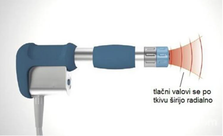 Новинка 2020 система физической терапии 8 бар бесконечные снимки акустическая