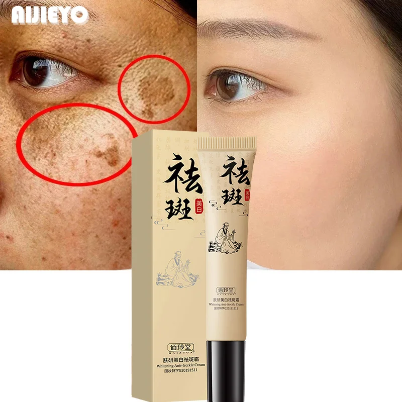 

Effective Whitening Freckle Cream 20g Remove Melasma Acne Spot Pigment Melanin Dark Spots Whitening Moisturizing Cream Skin Care