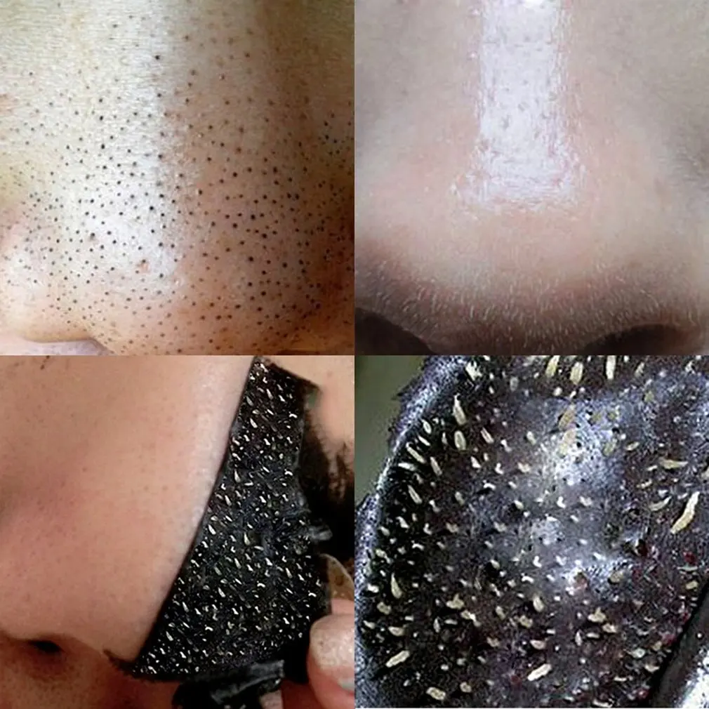 

Tear-off Blackhead Sticker Blackhead Remover Spots Acne Treatment Mask Nose Cleaner Pores Deep Cleaning Strip