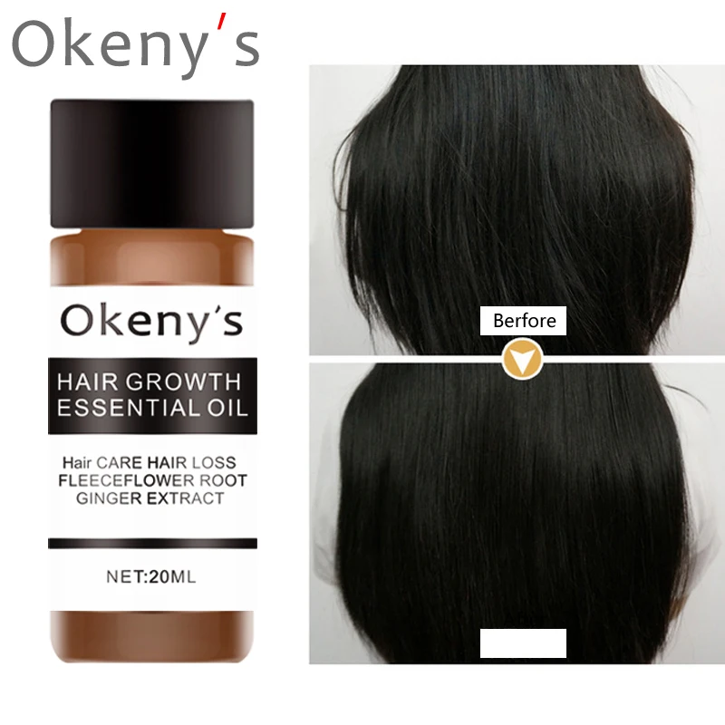 Okeny's быстрые мощные средства с эссенцией для рост волос Эфирное Масло жидкое