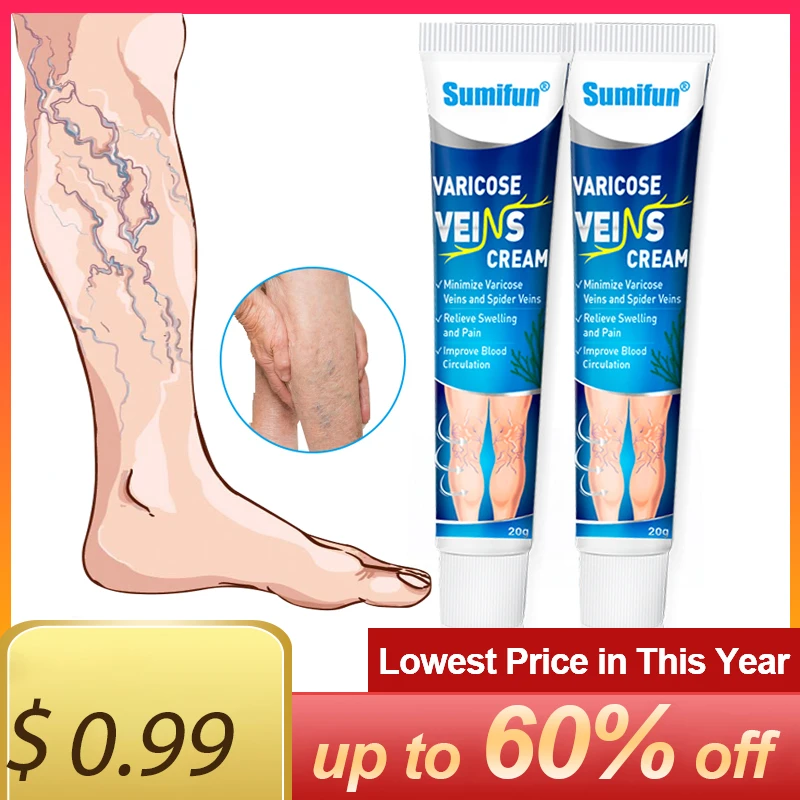 

Sumifun Only $0.99 Varicose Veins Ointment Medical Plaster Vasculitis Phlebitis Spider Leg Ointment Herb Angiitis Removal Patch