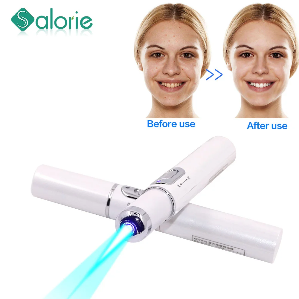 Портативная лазерная ручка для удаления морщин от акне прочное мягкое