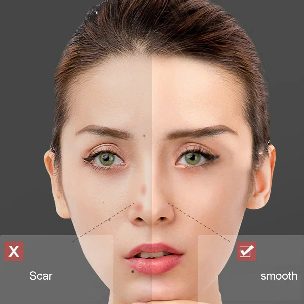 Плазменная ручка с 9 уровнями ЖК-дисплей для удаления родинок татуировок