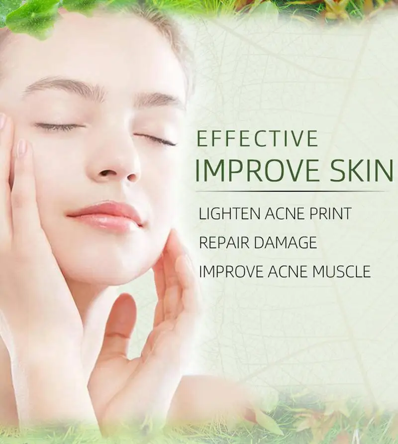 

Tea Tree Anti-acne Cream Oil Control Cleansing Plant Cream Diminishes Acne Anti-acne Skin Face Care Beauty TSLM1