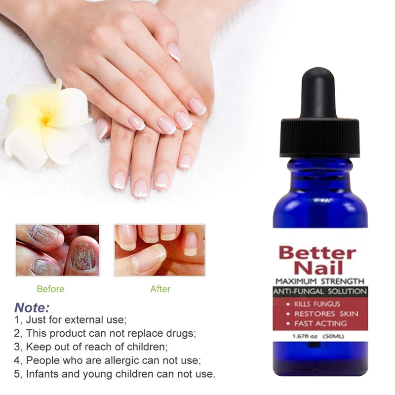 50ml Nail Repair Liquid Anti Fungus Toe Serum Remove Onychomycosis Essence Treatment Hand Foot Care ZGO | Красота и здоровье