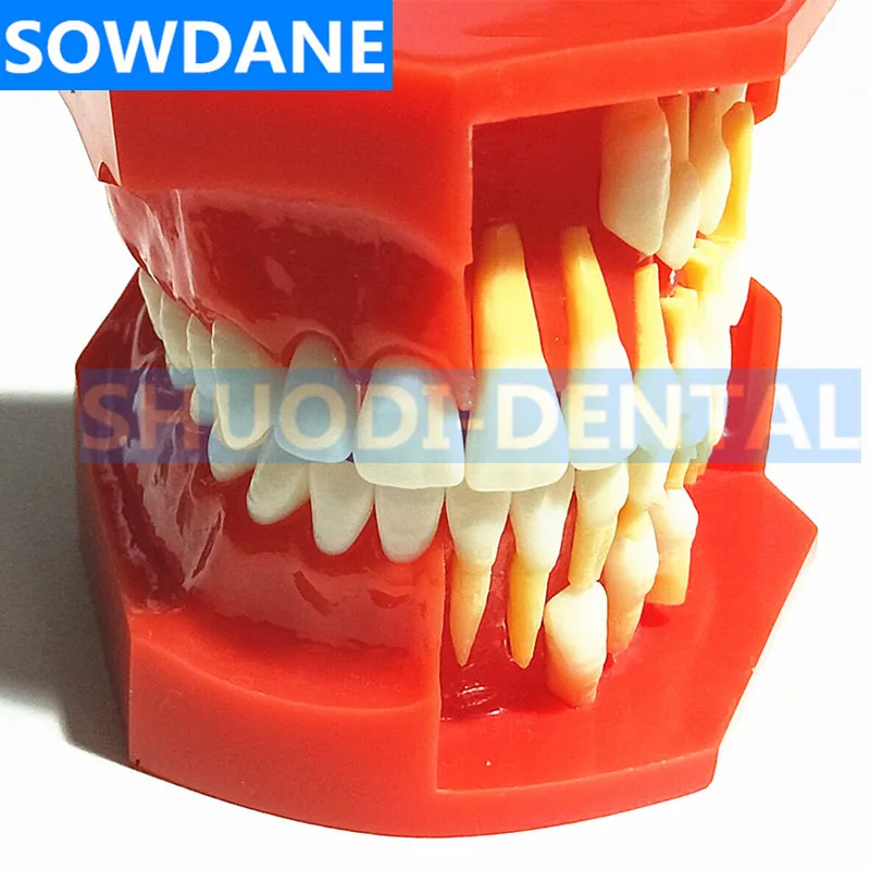 Стоматологическая детская модель выпадающих зубов сменная постоянные зубы