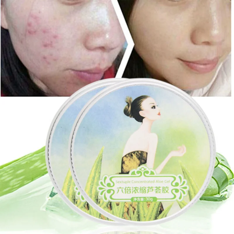 Натуральный гель с алоэ вера супер-увлажняющий противовоспалительный для