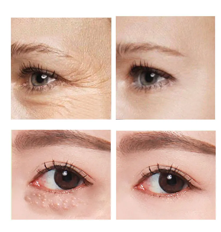 

circles, delays aging, reduces wrinkles, tightens and