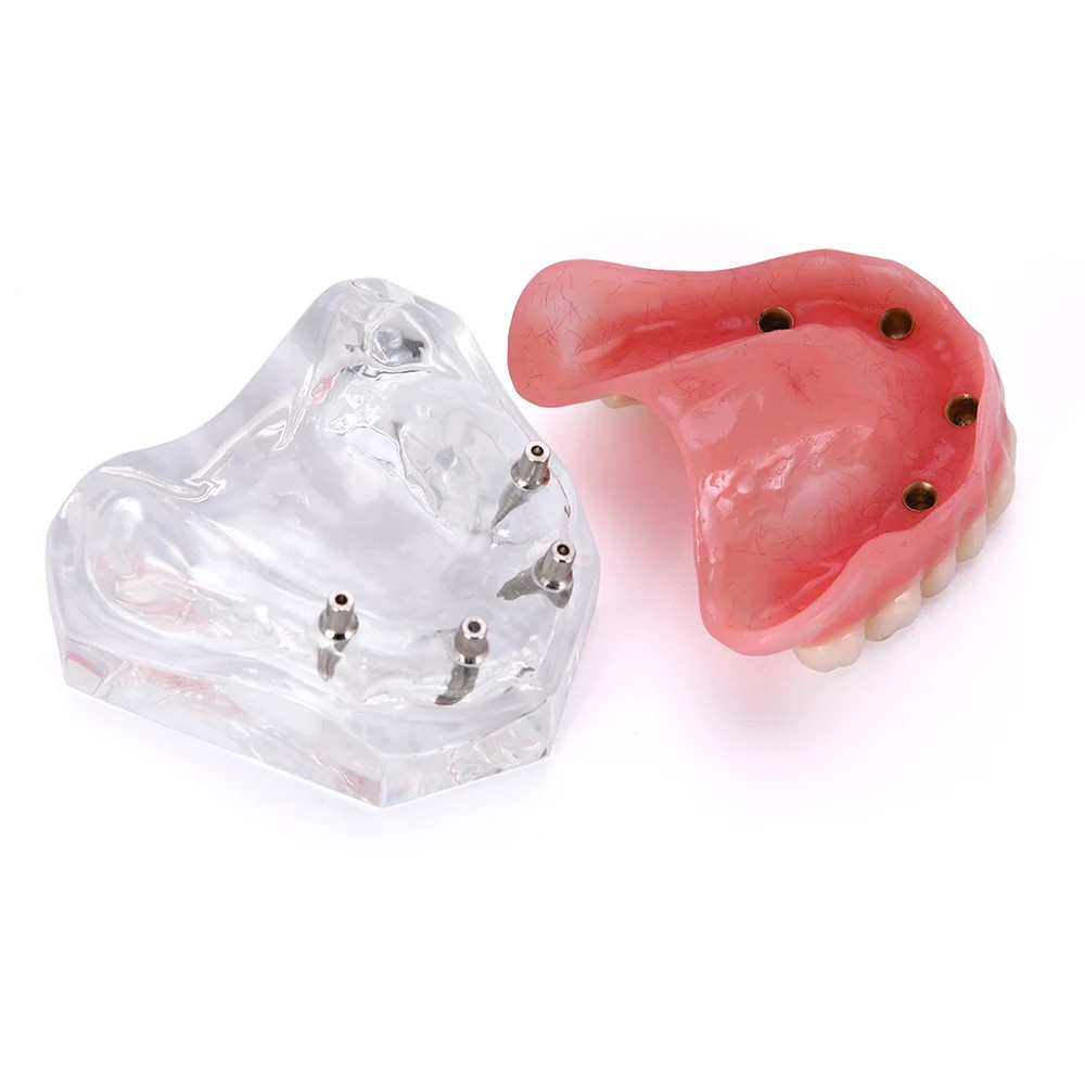 Модель зубных протезов съемная модель внутренней челюстной нижней части зубов