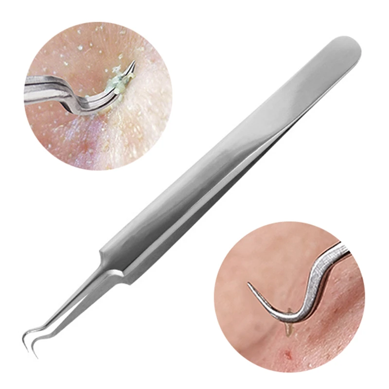 Stainless Steel Acne Removal Needles Pimple Blackhead Remover Tools Spoons Face Skin Care Facial Pore Cleaner |