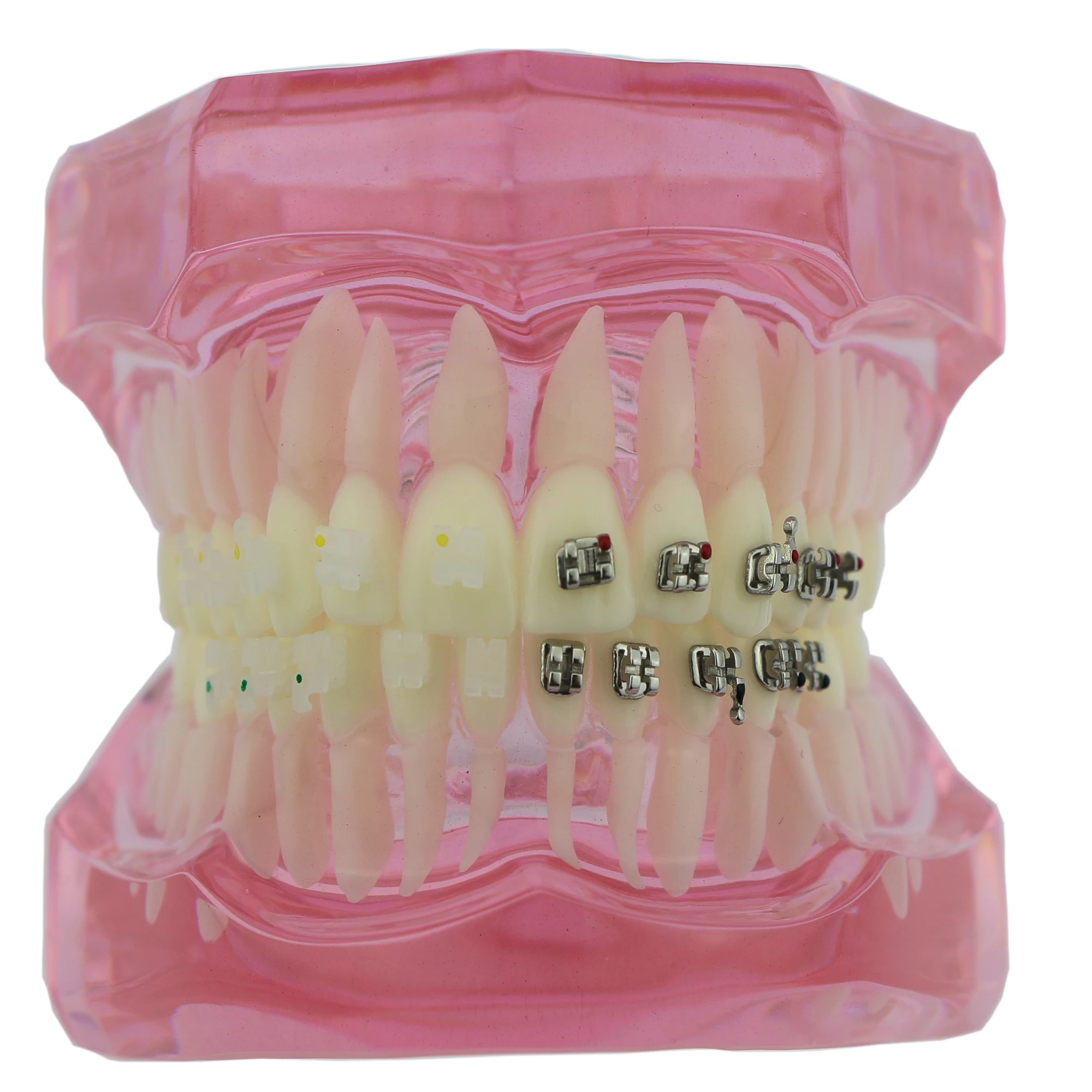 

Dental Teeth Study Orthodontic Model with Metal and Ceramic Brackets 3003 Pink