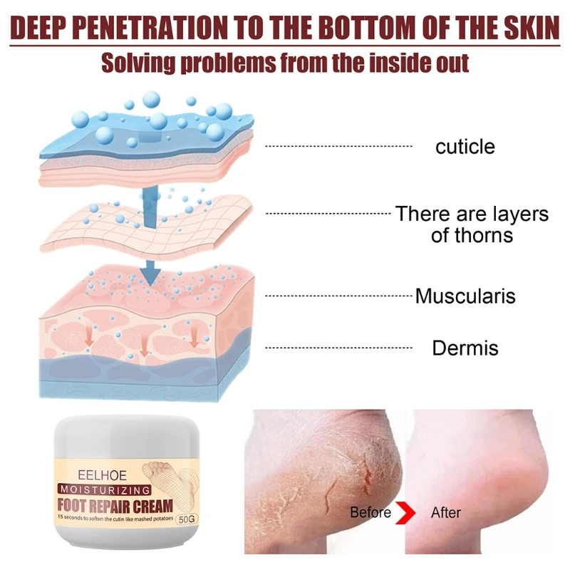 10 г Крем против трещин для ног маска сухости восстанавливающий крем с трещинами