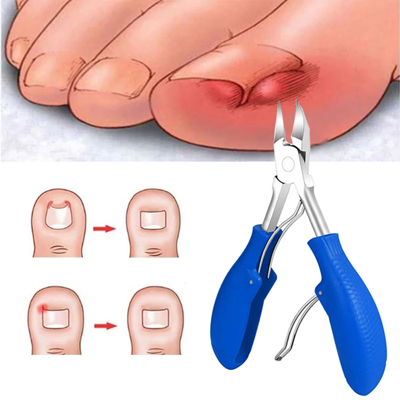 

Manicure Tool Pedicure Dead Skin Remover Toenails Nippers Toe Thick Nail Clippers Nail Correction Nails Ingrown Cutters