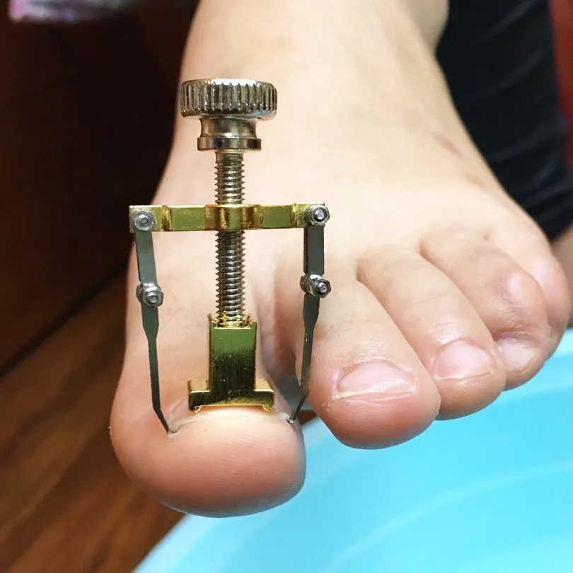 Инструмент для педикюра и ухода за ногами корректор вросших ногтей