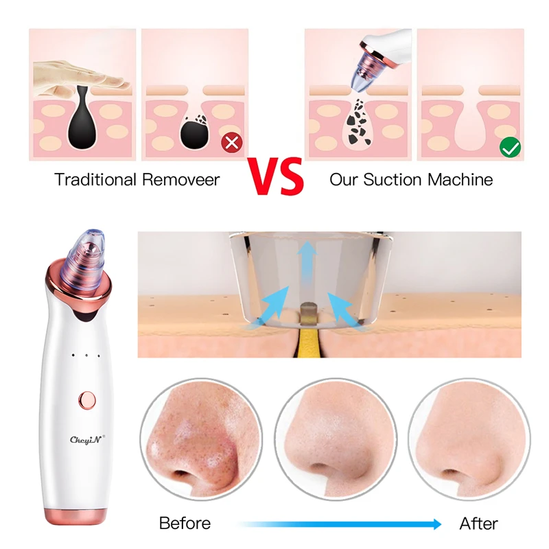 

Professional Hot Facial Steamer Nano Mist Deep Pore Cleanser Face Steaming Sauna Spa Humidifier Skin Beauty + Blackhead Removal