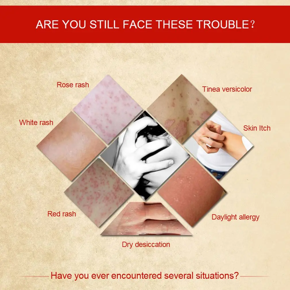 NEW15g натуральная китайская медицина травяной Антибактериальный крем лечение