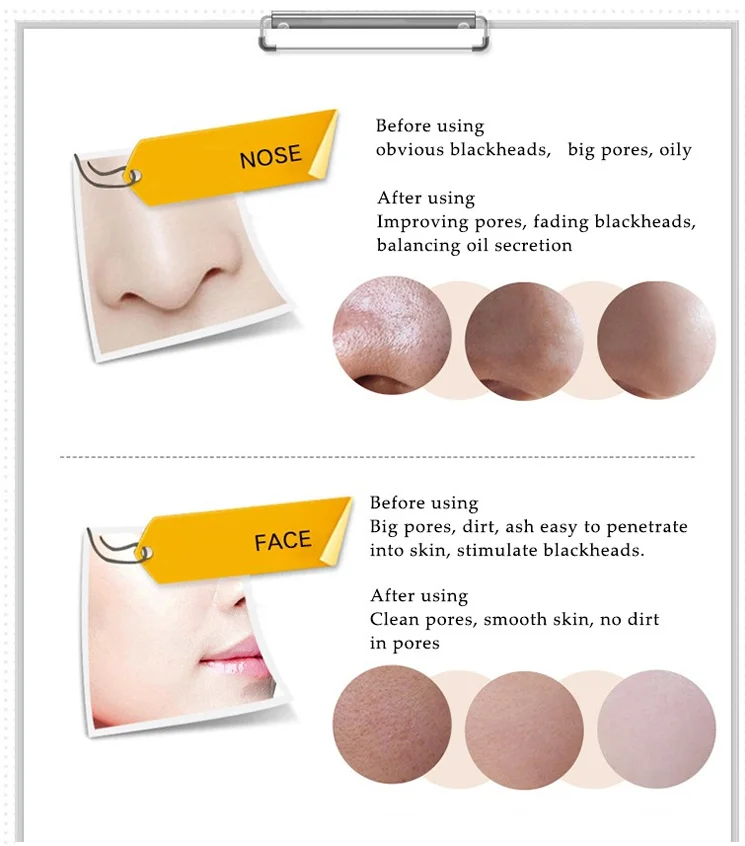 Средство для удаления черных точек черная маска ухода за кожей лица отбеливание