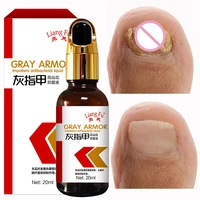 new nail fungal nail repair essence serum treatment care foot nail fungus removal gel anti infection paronychia onychomycosis