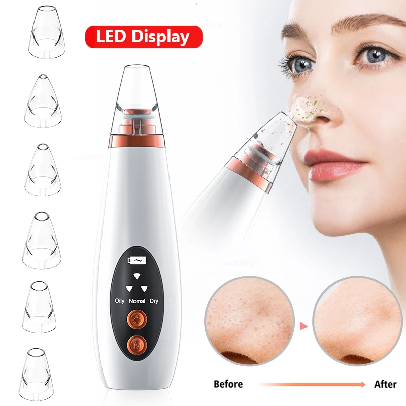 

drop ship special link Blackhead Remover Face Vacuum Skin Care Acne Pore Cleaner Pimple Removal Vacuum Suction Facial Tools