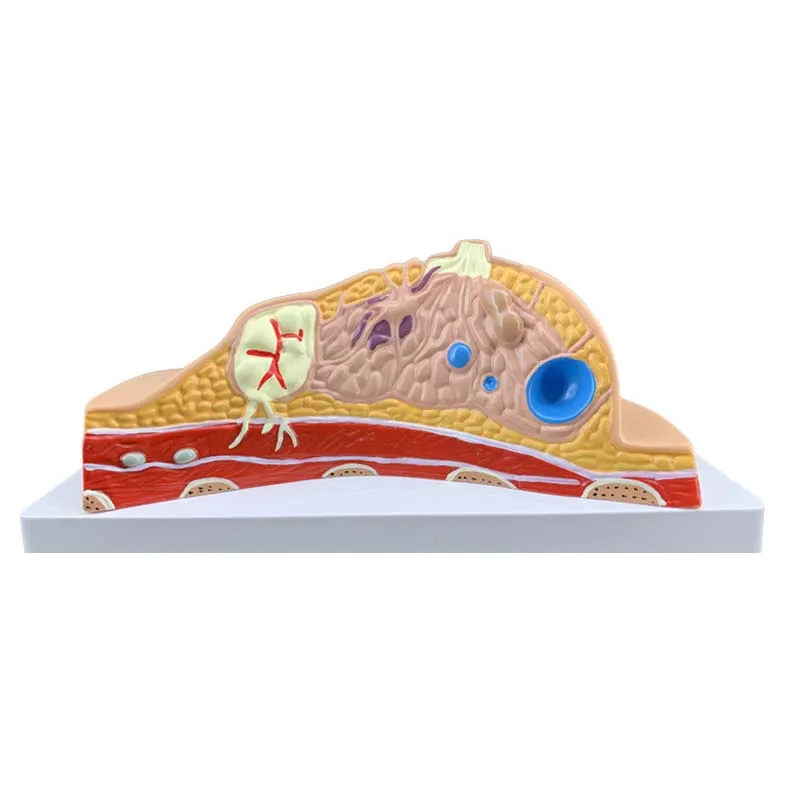 

Breast lesion model breast anatomy model breast feeding training aids