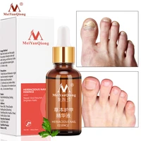herbal fungal nail treatment essential oil hand and foot whitening toe nail fungus removal infection feet care polish nail gel