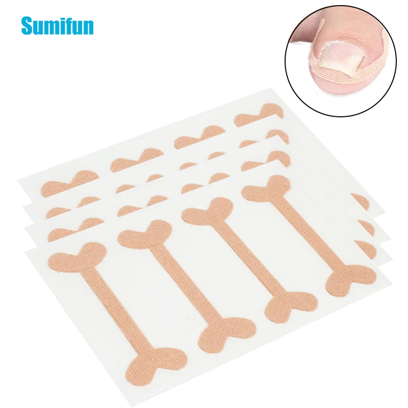 

40pcs Ingrown Toenails Band Aid Relief Pain Paronychia Correction Sticker Self-adhesive Repair Bandage for Toe Nail Correct Car