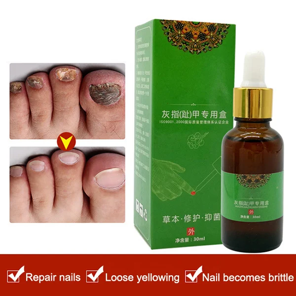 

Жидкая эссенция для удаления грибка ногтей на ногах Восстанавливающая увлажняющая Очищающая лечение 11 SSwell