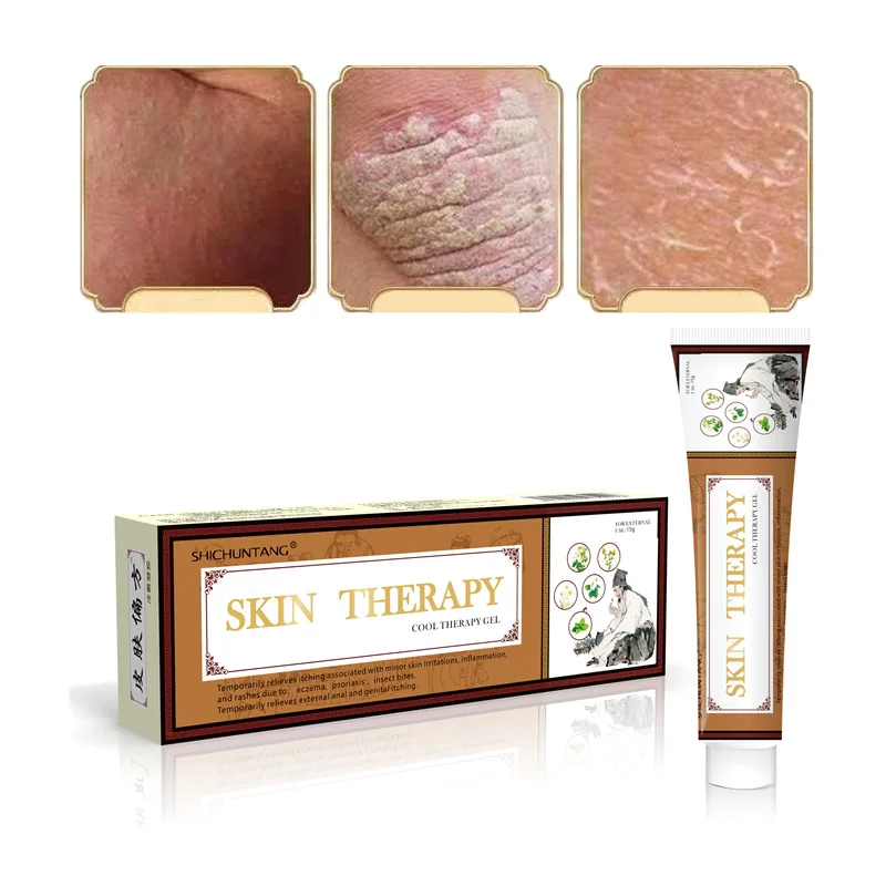 

15g Psoriasis and Eczema Cream Chinese Herbal Medicine Is Suitable for Various Skin Problems Body Massage and Anti-itch Ointment