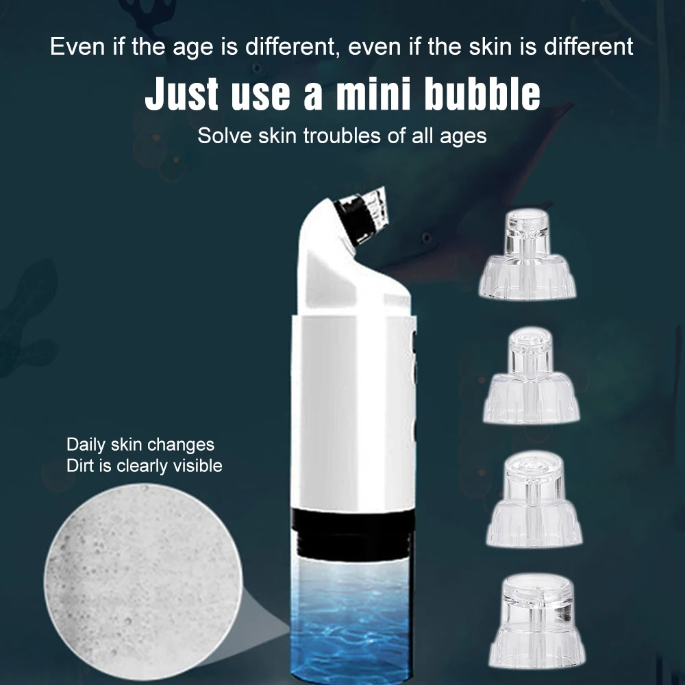 Аппарат для удаления чёрных точек со светодиодсветильник | Красота и здоровье