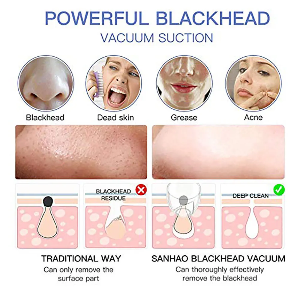 Средство для удаления черных точек на лице FRESHME средство глубокого очищения пор