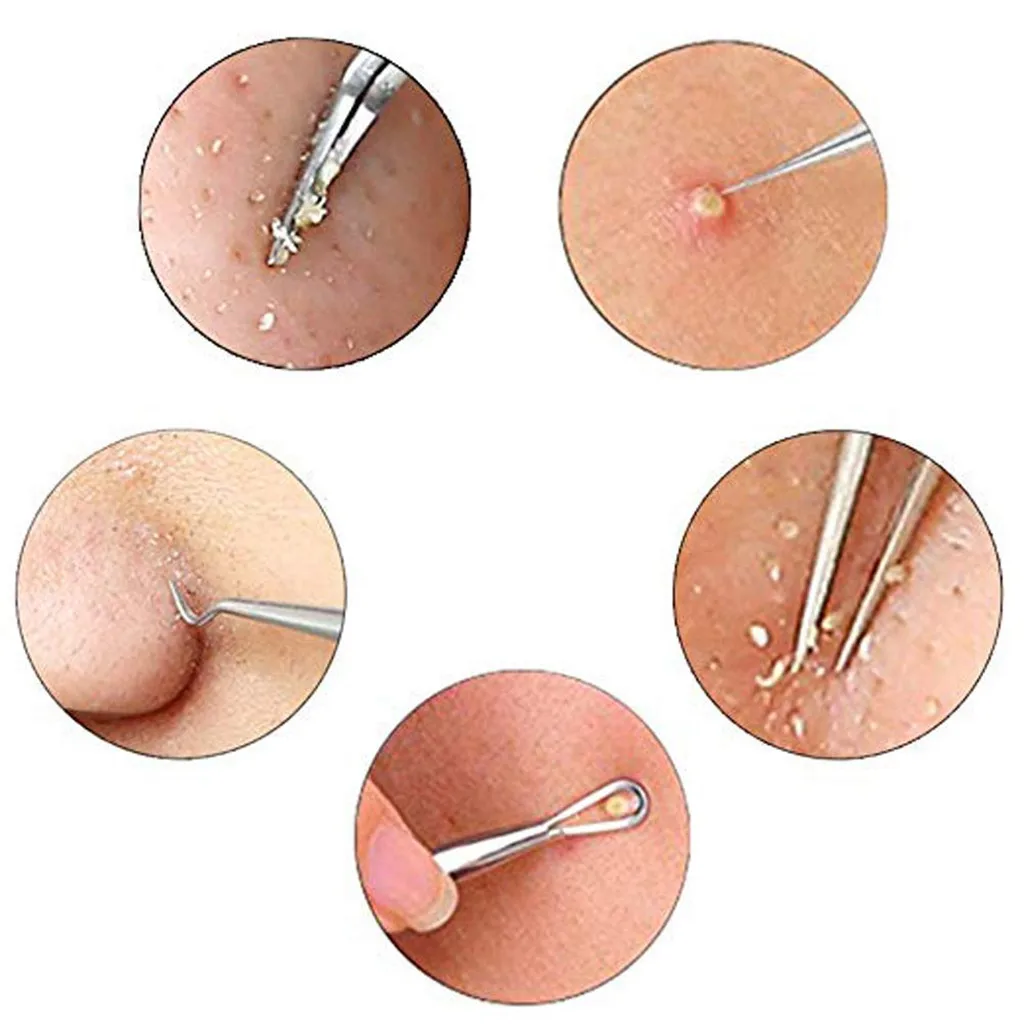 

7PCS blackhead acne acne pin remover set acne tool beauty setStainless steel blackhead acne needle