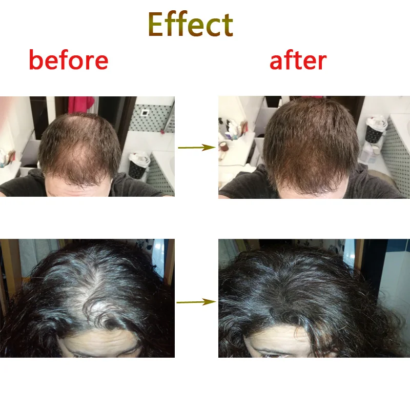 Домашний Применение черный 27 5 г волокна здания волос кератина Мгновенно Fibras