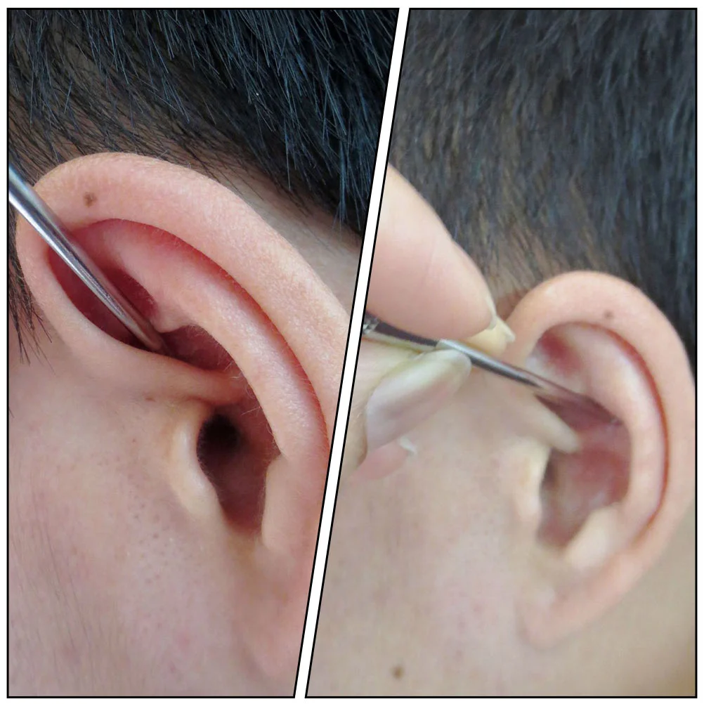 2Pcs Practical Ear Massagers Portable Acupuncture Point Pens (Silver) | Красота и здоровье