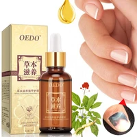 30ml herbal fungal nail treatment essential oil hand foot onychomycosis anti fungal nail infection toe fungus polish nail gel