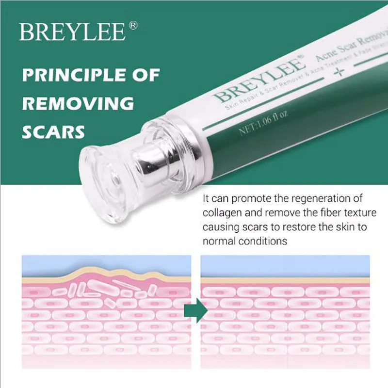 BREYLEE Scar Removal Cream Skin Care Face For Acne Stretch Remove Maternity Treatment Repair | Красота и здоровье